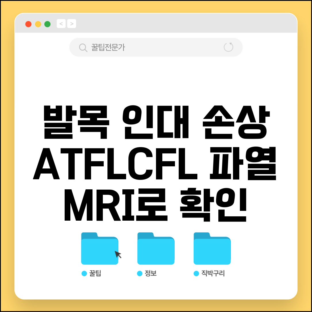 발목MRI 외측인대손상 ATFL CFL 파열 등급 | 발목 외측 인대 전거비 종비 인대